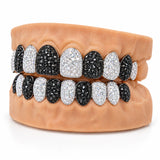 Black and white alternating moissanite grillz, side profile