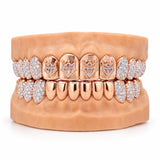 Full rose gold moissanite grillz with four stone outlined Adamans crown emblems on the upper teeth and iced side teeth, front view