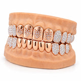 Full rose gold Adamans crown emblem grillz with polished lower set, side profile