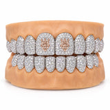Fully iced silver moissanite grillz with the rose gold Adamans crown and diamond emblem on both center teeth, front view