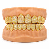 Fully iced gold moissanite grillz with yellow stones across upper and lower teeth, front view