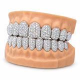 Fully iced silver moissanite grillz showing stone coverage across the arch, side profile
