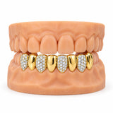 Gold lower grillz alternating polished gold teeth with iced moissanite teeth, front view