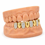 Gold and iced alternating lower grillz, side profile