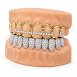 Gold open face upper grillz with iced silver lower set, side profile